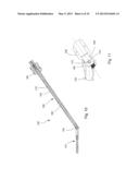 TELESCOPING SCREW FOR FEMORAL NECK FRACTURES diagram and image