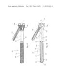 TELESCOPING SCREW FOR FEMORAL NECK FRACTURES diagram and image