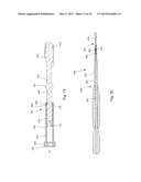 TELESCOPING SCREW FOR FEMORAL NECK FRACTURES diagram and image