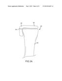 ARTHROPLASTY DEVICES AND RELATED METHODS diagram and image