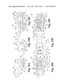 DEVICES AND METHODS FOR PERFORMING KNEE ARTHROPLASTY diagram and image