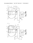 DEVICES AND METHODS FOR PERFORMING KNEE ARTHROPLASTY diagram and image