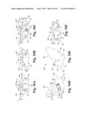 DEVICES AND METHODS FOR PERFORMING KNEE ARTHROPLASTY diagram and image