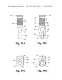 DEVICES AND METHODS FOR PERFORMING KNEE ARTHROPLASTY diagram and image