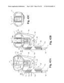 DEVICES AND METHODS FOR PERFORMING KNEE ARTHROPLASTY diagram and image