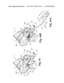 DEVICES AND METHODS FOR PERFORMING KNEE ARTHROPLASTY diagram and image