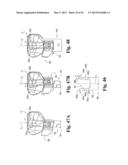 DEVICES AND METHODS FOR PERFORMING KNEE ARTHROPLASTY diagram and image