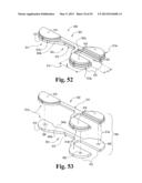 DEVICES AND METHODS FOR PERFORMING KNEE ARTHROPLASTY diagram and image