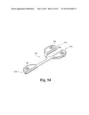 DEVICES AND METHODS FOR PERFORMING KNEE ARTHROPLASTY diagram and image