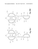 DEVICES AND METHODS FOR PERFORMING KNEE ARTHROPLASTY diagram and image