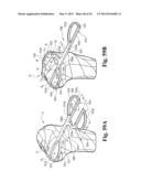 DEVICES AND METHODS FOR PERFORMING KNEE ARTHROPLASTY diagram and image