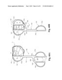 DEVICES AND METHODS FOR PERFORMING KNEE ARTHROPLASTY diagram and image