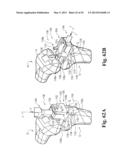 DEVICES AND METHODS FOR PERFORMING KNEE ARTHROPLASTY diagram and image