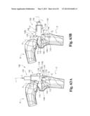 DEVICES AND METHODS FOR PERFORMING KNEE ARTHROPLASTY diagram and image