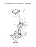 DEVICES AND METHODS FOR PERFORMING KNEE ARTHROPLASTY diagram and image