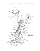 DEVICES AND METHODS FOR PERFORMING KNEE ARTHROPLASTY diagram and image