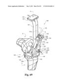 DEVICES AND METHODS FOR PERFORMING KNEE ARTHROPLASTY diagram and image