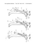 DEVICES AND METHODS FOR PERFORMING KNEE ARTHROPLASTY diagram and image