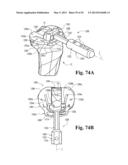 DEVICES AND METHODS FOR PERFORMING KNEE ARTHROPLASTY diagram and image