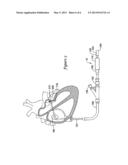 HANDLE ASSEMBLY FOR A LEFT ATRIAL APPENDAGE OCCLUSION DEVICE diagram and image