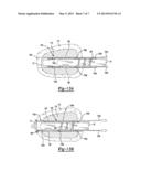 Method And Apparatus For Stitching Tendons diagram and image