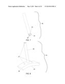 PARTIAL JOINT RESURFACING IMPLANT, INSTRUMENTATION, AND METHOD diagram and image