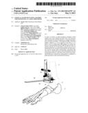 SURGICAL INSTRUMENTATION ASSEMBLY FOR POSITIONING AN ANKLE PROSTHESIS diagram and image