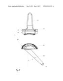 SURGICAL INSTRUMENTATION ASSEMBLY FOR POSITIONING AN ANKLE PROSTHESIS diagram and image