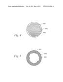 MAGNETIC IMPLANTS AND METHODS FOR TREATING AN OROPHARYNGEAL CONDITION diagram and image