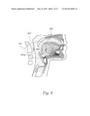 MAGNETIC IMPLANTS AND METHODS FOR TREATING AN OROPHARYNGEAL CONDITION diagram and image