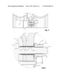 DUAL WHEEL CENTERING SYSTEM, METHOD AND KIT diagram and image