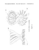 Method and Apparatus for Reclaiming Heat During Liquid Purification Using     Heat Exchanges diagram and image