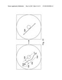 Medical Mounting System and Method diagram and image