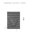 3D INTRAORAL MEASUREMENTS USING OPTICAL MULTILINE METHOD diagram and image