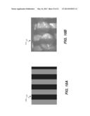 3D INTRAORAL MEASUREMENTS USING OPTICAL MULTILINE METHOD diagram and image