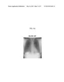 X-RAY IMAGING APPARATUS AND METHOD FOR CONTROLLING THE SAME diagram and image