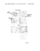 METHOD AND PHARMACOLOGICAL COMPOSITION FOR THE DIAGNOSIS AND TREATMENT OF     MALE SUB-FERTILITY diagram and image