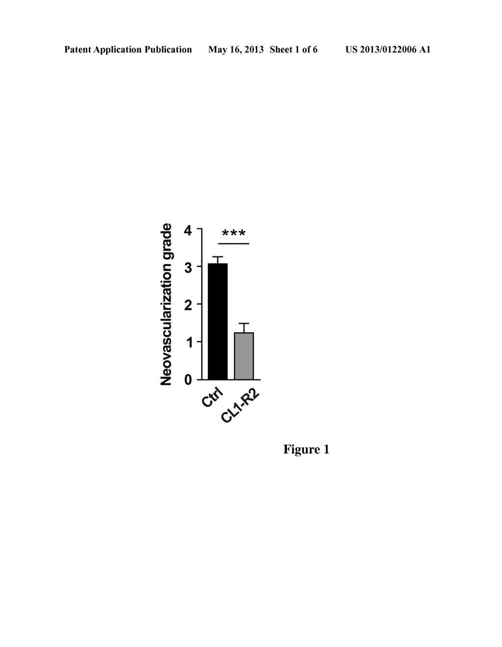 ANTI-CD160 SPECIFIC ANTIBODIES FOR THE TREATMENT OF EYE DISORDERS BASED ON     NEOANGIOGENESIS - diagram, schematic, and image 02