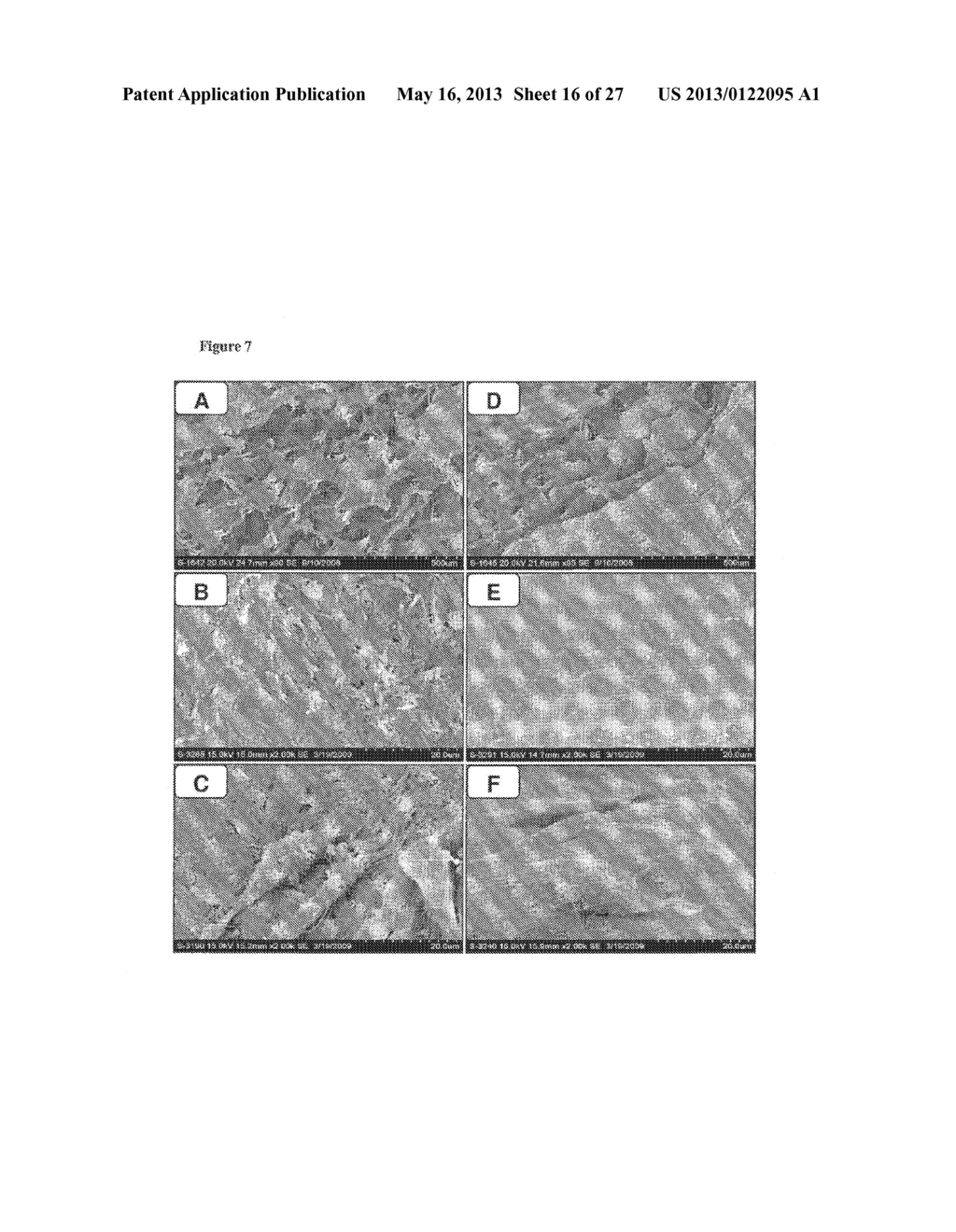 PLATELET-DERIVED GROWTH FACTOR COMPOSITIONS AND METHODS FOR THE TREATMENT     OF OSTEOCHONDRAL DEFECTS - diagram, schematic, and image 17