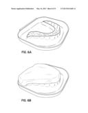 DIRECT MANUFACTURE OF ORTHODONTIC ALIGNER APPLIANCE diagram and image