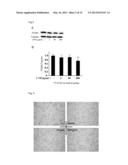 DRUG INHIBITING THE PROGRESSION OF ATHEROSCLEROSIS, PREVENTIVE DRUG, BLOOD     CHOLESTEROL-LOWERING DRUG, FUNCTIONAL FOOD, AND SPECIFIC HEALTH FOOD diagram and image