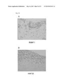 DRUG INHIBITING THE PROGRESSION OF ATHEROSCLEROSIS, PREVENTIVE DRUG, BLOOD     CHOLESTEROL-LOWERING DRUG, FUNCTIONAL FOOD, AND SPECIFIC HEALTH FOOD diagram and image