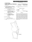 METHOD FOR IMPROVING CARTILAGE REPAIR AND/OR PREVENTING CARTILAGE     DEGENERATION IN A JOINT diagram and image