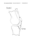 METHOD FOR IMPROVING CARTILAGE REPAIR AND/OR PREVENTING CARTILAGE     DEGENERATION IN A JOINT diagram and image