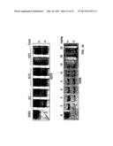 Soluble TNF Receptors and Their Use in Treatment of Disease diagram and image