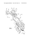 SELF-RETAINING RETRACTOR diagram and image