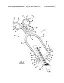 SELF-RETAINING RETRACTOR diagram and image