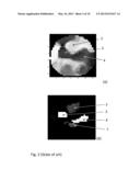 Method and Apparatus for the Non-Invasive Measurement of Pulse Transit     Times (PTT) diagram and image