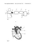 Method and Apparatus for the Non-Invasive Measurement of Pulse Transit     Times (PTT) diagram and image