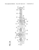 ACTUATED SELF UNPLUGGING SURGICAL SUCKER WAND diagram and image